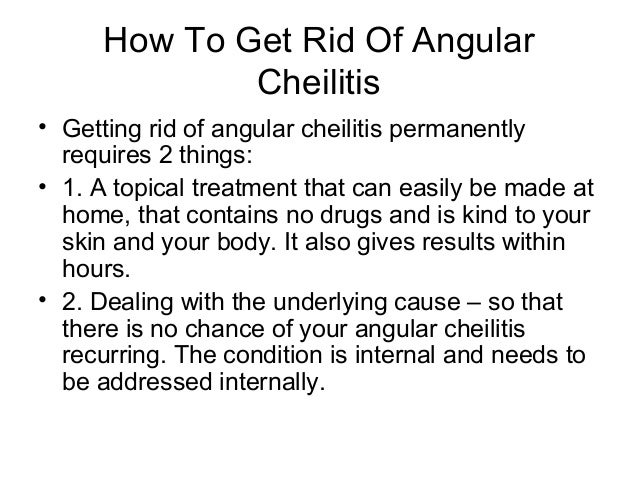 How do I get rid of angular cheilitis?