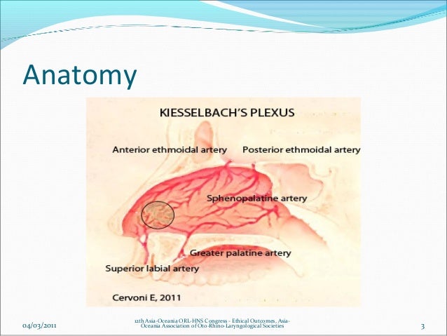 Recurring anterior epistaxis