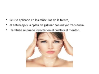 • Se usa aplicado en los músculos de la frente,
• el entrecejo y la "pata de gallina" con mayor frecuencia.
• También se puede inyectar en el cuello y el mentón.
 