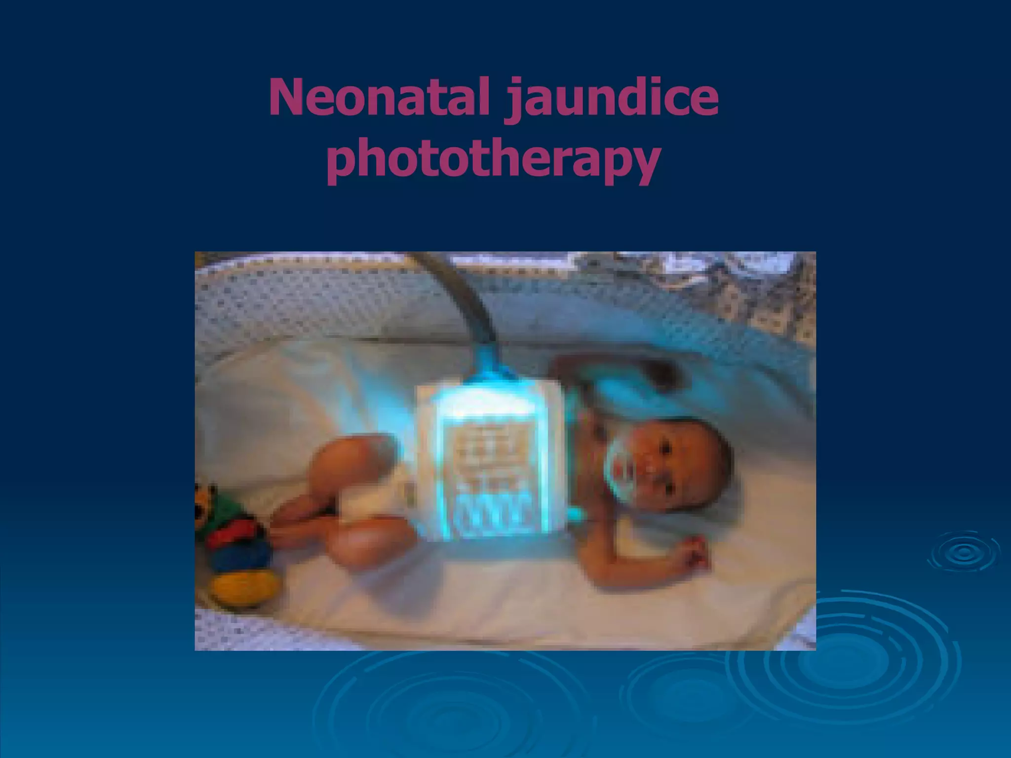 Neonatal jaundice phototherapy 