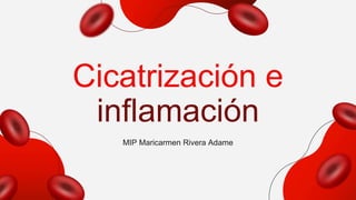 Cicatrización e
inflamación
MIP Maricarmen Rivera Adame
 