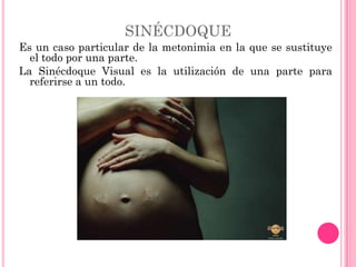 SINÉCDOQUE
Es un caso particular de la metonimia en la que se sustituye
  el todo por una parte.
La Sinécdoque Visual es la utilización de una parte para
  referirse a un todo.
 