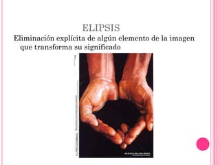 ELIPSIS
Eliminación explícita de algún elemento de la imagen
  que transforma su significado
 