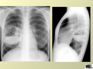 Redactarea unui buletin radiologic | PPT