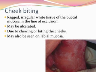 Red and White Lesions | PDF