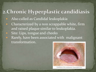  Also called as Candidal leukoplakia
 Characterized by a non scrappable white, firm
and raised plaque similar to leukoplakia.
 Site: Lips, tongue and cheeks
 Rarely, have been associated with malignant
transformation.
 