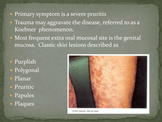  Primary symptom is a severe pruritis
 Trauma may aggravate the disease, referred to as a
Koebner phenomenon.
 Most frequent extra oral mucosal site is the genital
mucosa. Classic skin lesions described as
 Purplish
 Polygonal
 Planar
 Pruritic
 Papules
 Plaques
 