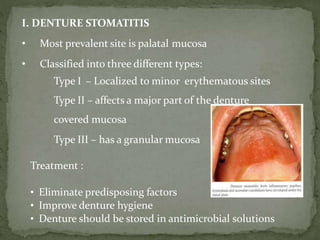 I. DENTURE STOMATITIS
• Most prevalent site is palatal mucosa
• Classified into three different types:
Type I – Localized to minor erythematous sites
Type II – affects a major part of the denture
covered mucosa
Type III – has a granular mucosa
Treatment :
• Eliminate predisposing factors
• Improve denture hygiene
• Denture should be stored in antimicrobial solutions
 