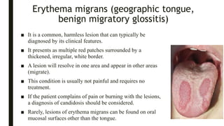 red-and-white-lesions-of-the-oral-mucosa-pptx