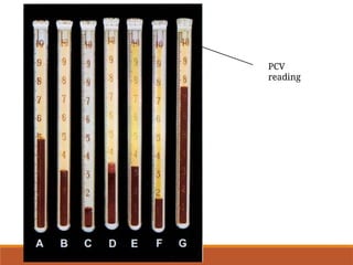 Pcv Value Lab Red blood cell indices. Types of blood indices | PPT