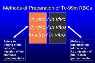 Methods of Preparation of Tc-99m RBCs

                    In vivo / in vivo
                    In vivo / in vitro
                   In vitro / in vitro
Refers to                                Refers to
tinning of the                           radiolabeling
cells, i.e.,                             of the cells,
injection of the                         i.e., injection of
stannous                                 the Tc-99m
pyrophosphate                            pertechnetate
 