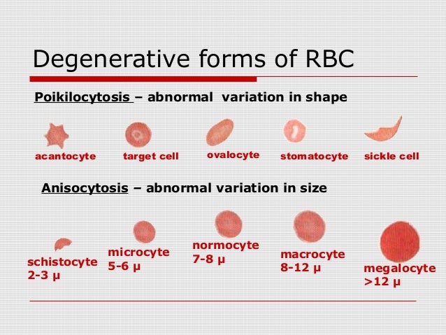 abnormal rbc morphology under fontanacountryinn com abnormal rbc morphology