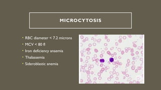 Normal Rbc En Micras Comprehensive Overview of Red Blood Cell Morphology and Disorders | PPTX