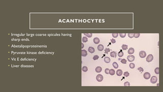 Spikey Rbc Comprehensive Overview of Red Blood Cell Morphology and Disorders | PPTX