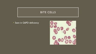 Comprehensive Overview of Red Blood Cell Morphology and Disorders | PPTX