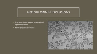 Comprehensive Overview of Red Blood Cell Morphology and Disorders | PPTX
