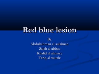 Red blue lesion
By
Abdulrahman al sulaiman
Saleh al abbas
Khalid al ahmary
Tariq al mutair

 