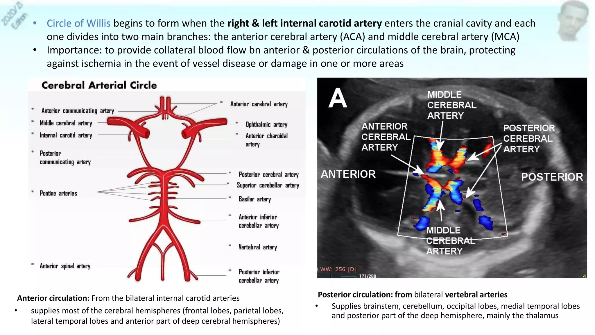 28
• Circle of Willis begins to form when the right & left internal carotid artery enters the cranial cavity and each
one divides into two main branches: the anterior cerebral artery (ACA) and middle cerebral artery (MCA)
• Importance: to provide collateral blood flow bn anterior & posterior circulations of the brain, protecting
against ischemia in the event of vessel disease or damage in one or more areas
Anterior circulation: From the bilateral internal carotid arteries
• supplies most of the cerebral hemispheres (frontal lobes, parietal lobes,
lateral temporal lobes and anterior part of deep cerebral hemispheres)
Posterior circulation: from bilateral vertebral arteries
• Supplies brainstem, cerebellum, occipital lobes, medial temporal lobes
and posterior part of the deep hemisphere, mainly the thalamus
 