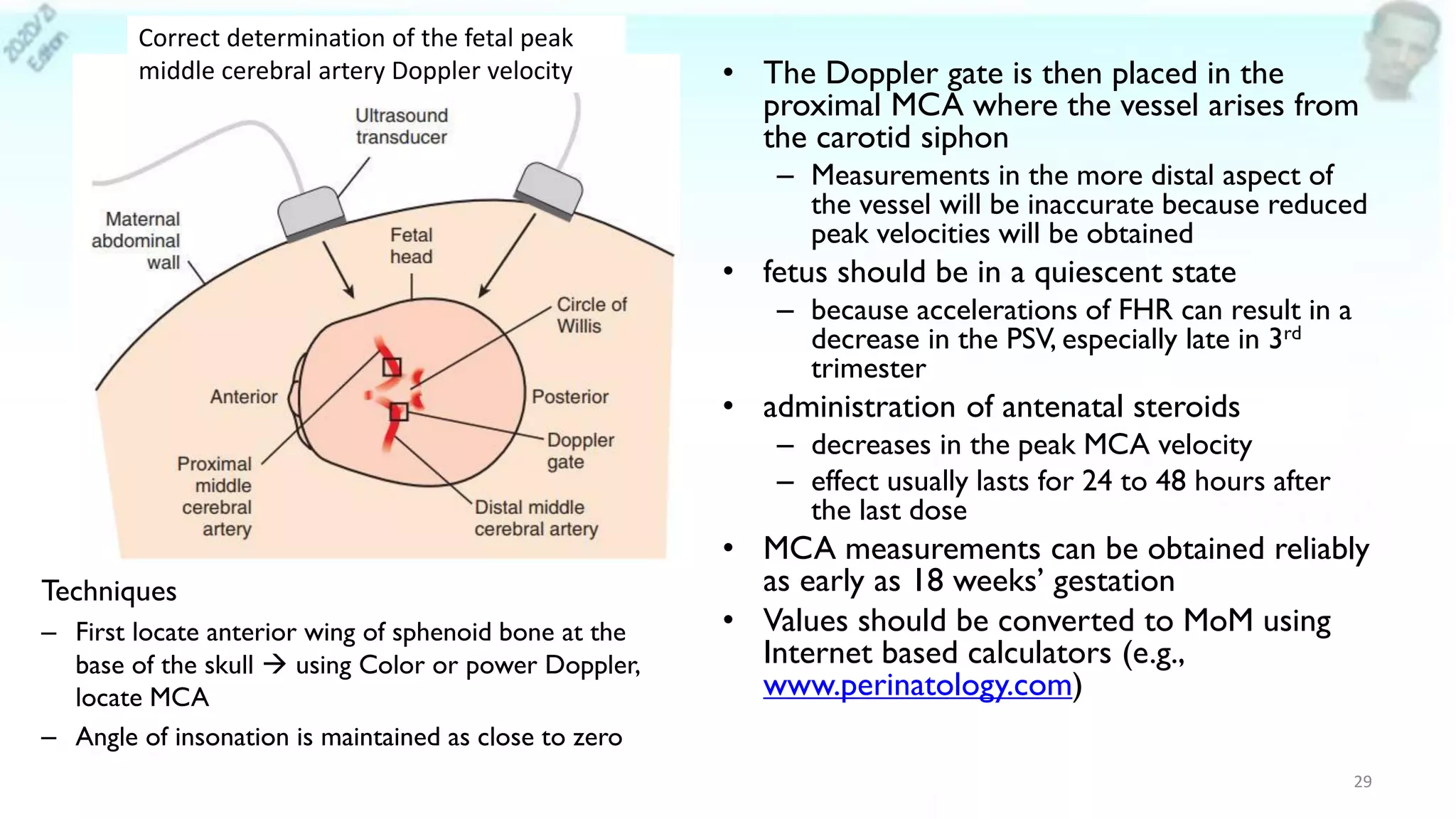 • The Doppler gate is then placed in the
proximal MCA where the vessel arises from
the carotid siphon
– Measurements in the more distal aspect of
the vessel will be inaccurate because reduced
peak velocities will be obtained
• fetus should be in a quiescent state
– because accelerations of FHR can result in a
decrease in the PSV, especially late in 3rd
trimester
• administration of antenatal steroids
– decreases in the peak MCA velocity
– effect usually lasts for 24 to 48 hours after
the last dose
• MCA measurements can be obtained reliably
as early as 18 weeks’ gestation
• Values should be converted to MoM using
Internet based calculators (e.g.,
www.perinatology.com)
29
Correct determination of the fetal peak
middle cerebral artery Doppler velocity
Techniques
– First locate anterior wing of sphenoid bone at the
base of the skull → using Color or power Doppler,
locate MCA
– Angle of insonation is maintained as close to zero
 