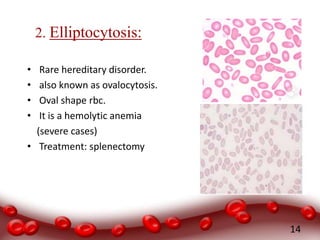 2. Elliptocytosis:
• Rare hereditary disorder.
• also known as ovalocytosis.
• Oval shape rbc.
• It is a hemolytic anemia
(severe cases)
• Treatment: splenectomy
14
 