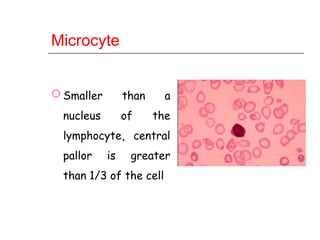 Microcyte Conditions Red blood Cells Morphology detailed .ppt