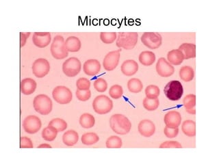Microcysts Rces Red blood Cells Morphology detailed .ppt