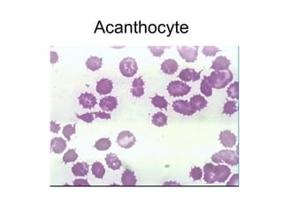 Red blood Cells Morphology detailed .ppt
