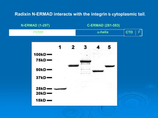 F
N-ERMAD (1-297) C-ERMAD (281-583)
FERM -helix CTD F
Radixin N-ERMAD interacts with the integrin b cytoplasmic tail.
 