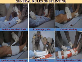 musculo skeletal injuries | PPTX