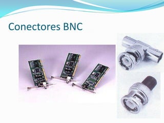 Conectores BNC
 
