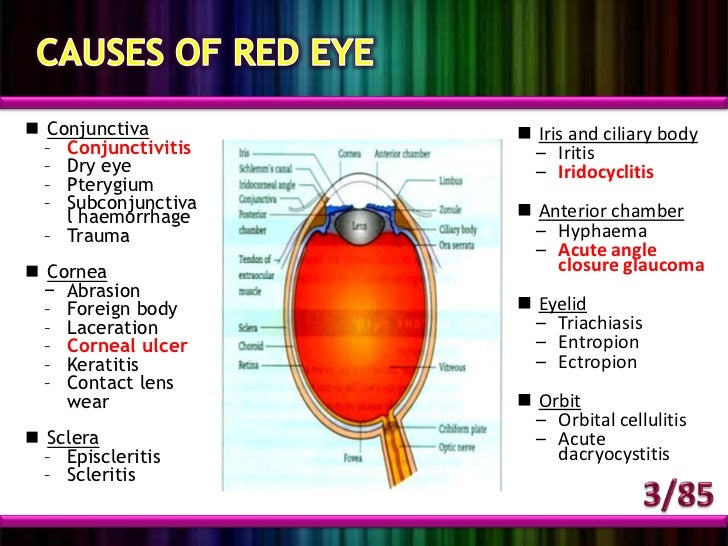 Red eye