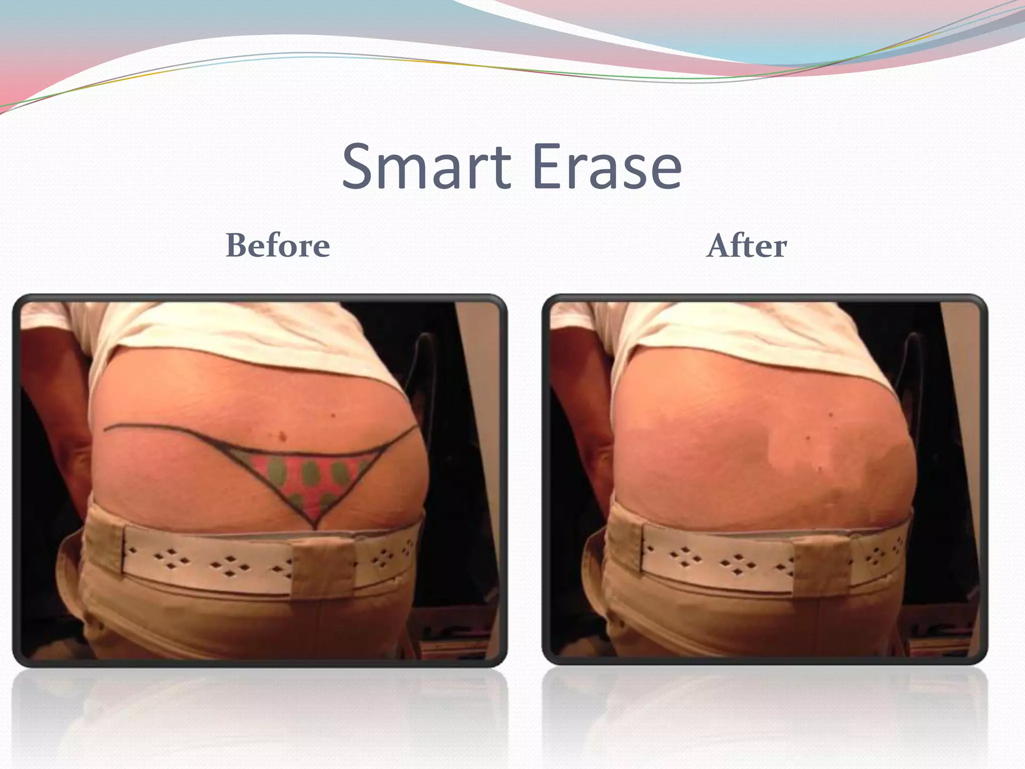 Smart Erase
Before                 After
 