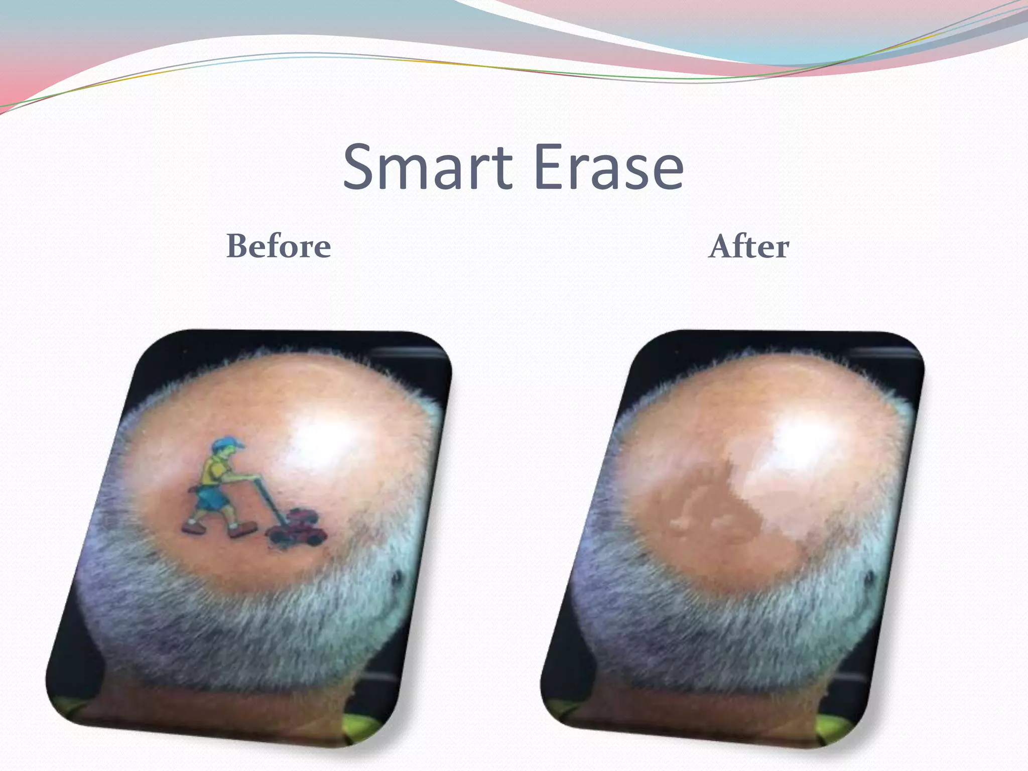 Smart Erase
Before                 After
 