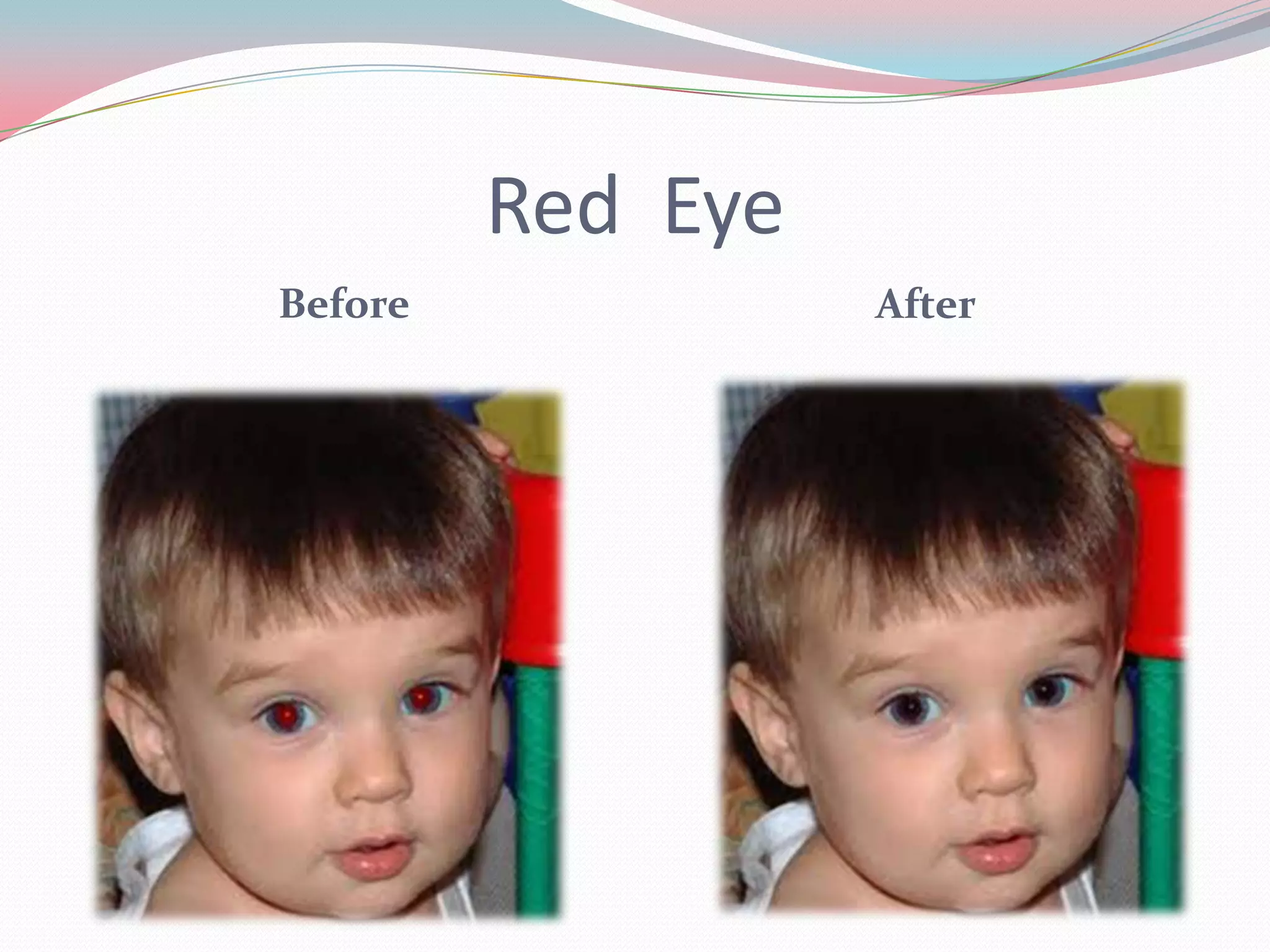 Red Eye
Before             After
 