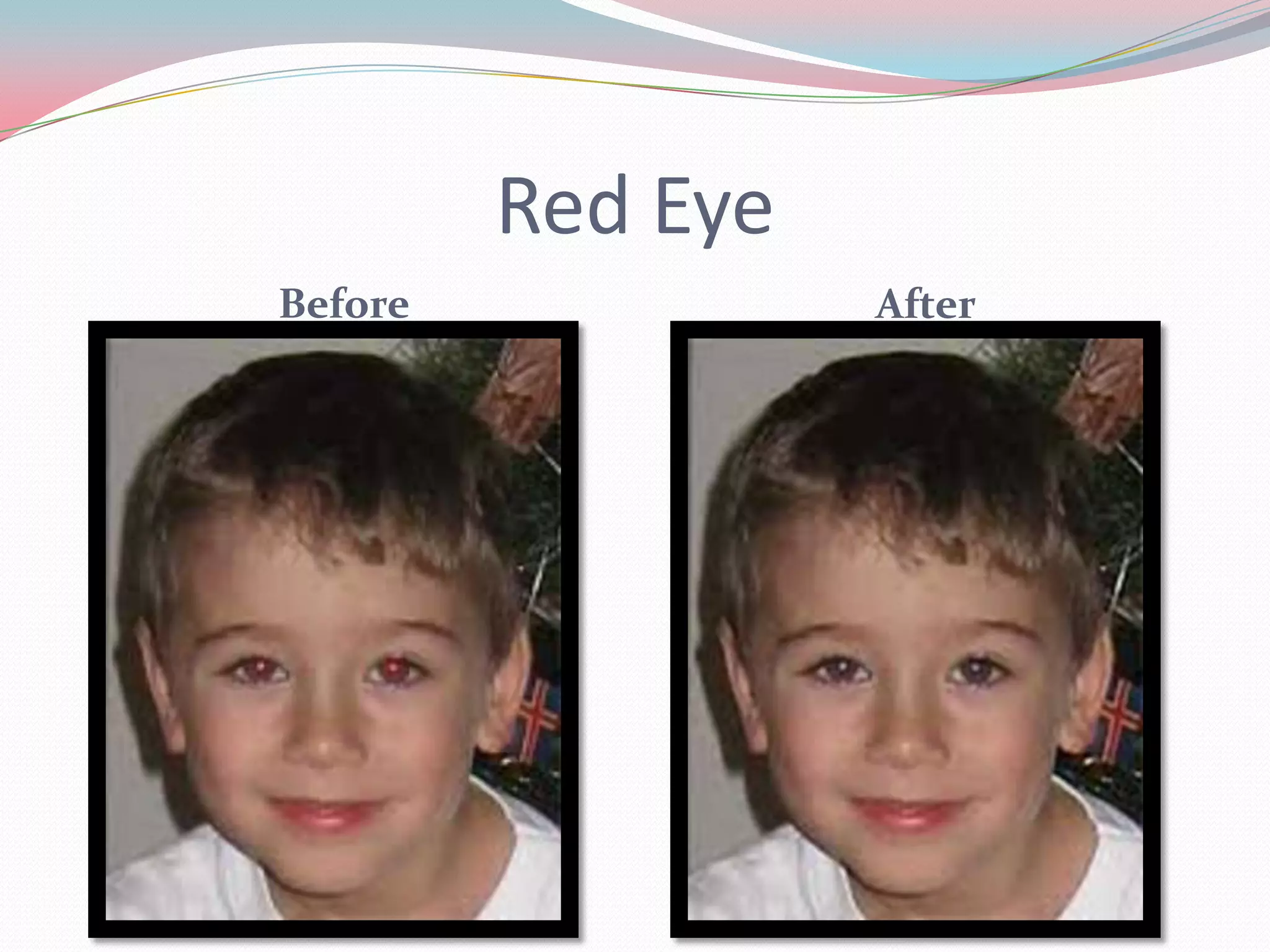 Red Eye
Before             After
 
