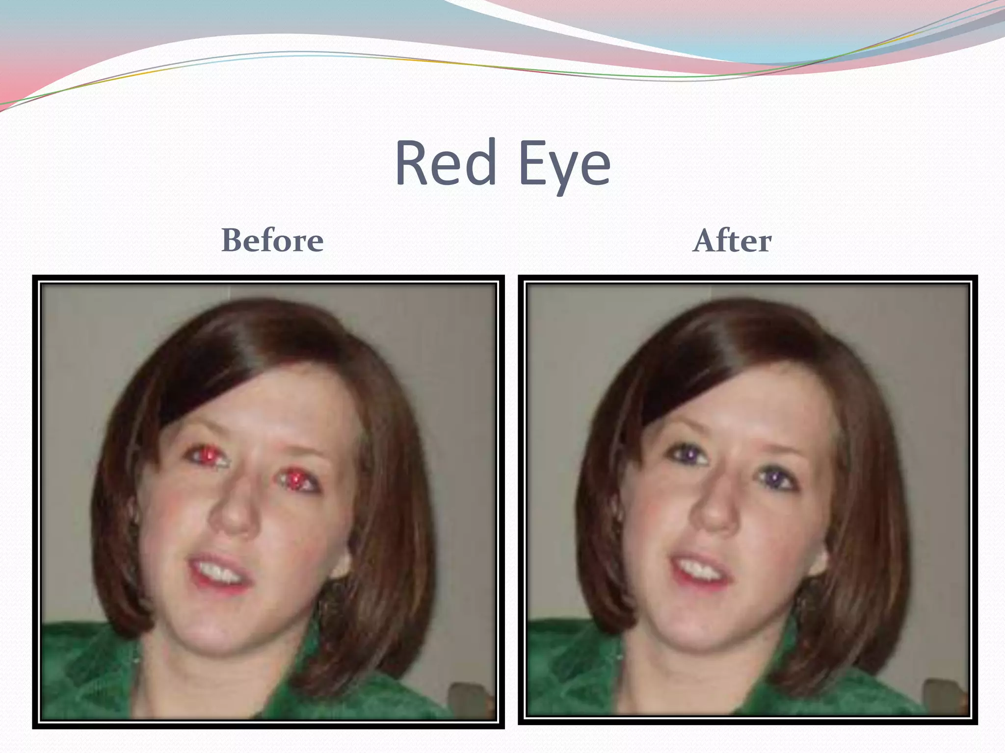 Red Eye
Before             After
 