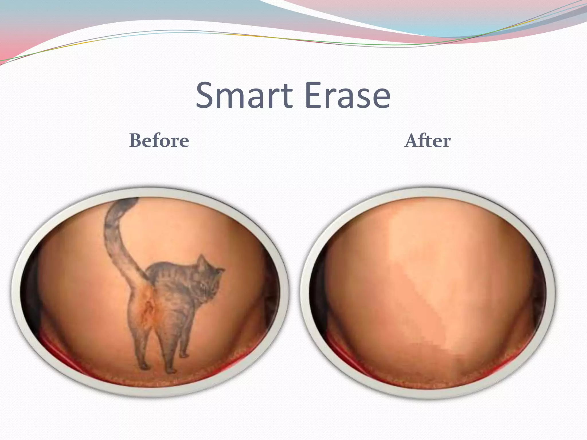 Smart Erase
Before                 After
 