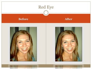 Red Eye
Before After