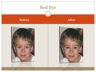 Red Eye
Before After