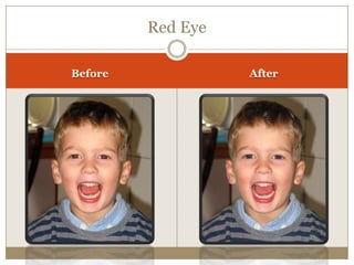 Red Eye
Before After