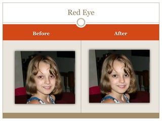 Red Eye
Before After