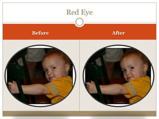 Red Eye
Before After