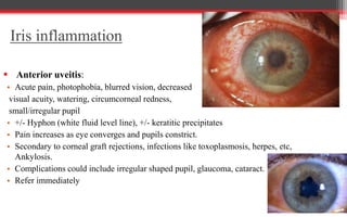 Red eye | PPTX