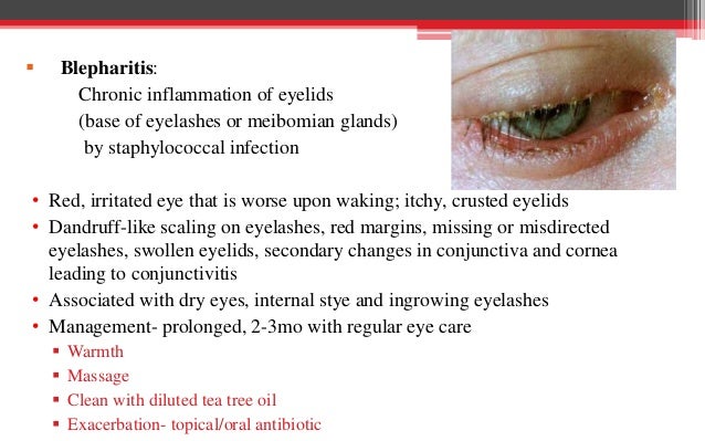 best oral antibiotic for eyelid infection