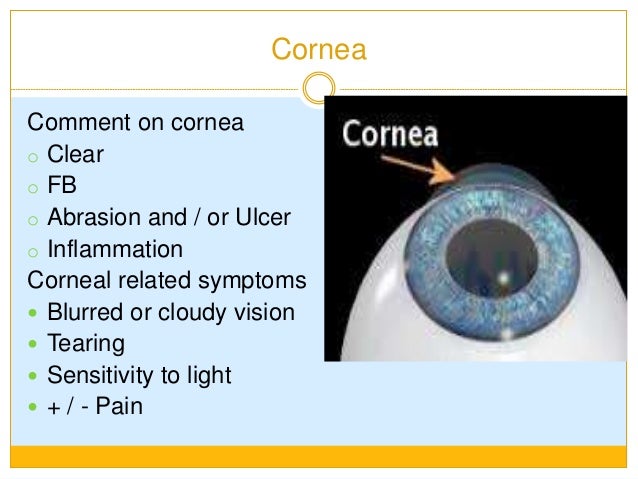 Cataract Surgery Recovery Complications Side Effects Risks