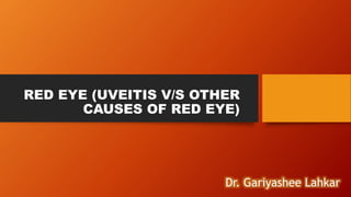 RED EYE (UVEITIS V/S OTHER
CAUSES OF RED EYE)
Dr. Gariyashee Lahkar
 