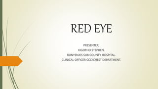 RED EYE
PRESENTER;
KIGOTHO STEPHEN.
RUNYENJES SUB COUNTY HOSPITAL.
CLINICAL OFFICER CCC/CHEST DEPARTMENT.
 