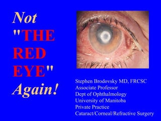 Not &quot; THE  RED EYE &quot; Again! Stephen Brodovsky MD, FRCSC Associate Professor Dept of Ophthalmology University of Manitoba Private Practice Cataract/Corneal/Refractive Surgery 