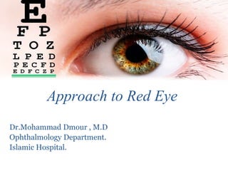 Approach to Red Eye
Dr.Mohammad Dmour , M.D
Ophthalmology Department.
Islamic Hospital.
 