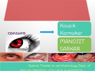 Kousik
Karmakar
MANOJIT
SARKAR
Special Thanks to ophthalmology Dept. of
SPEAKER
 